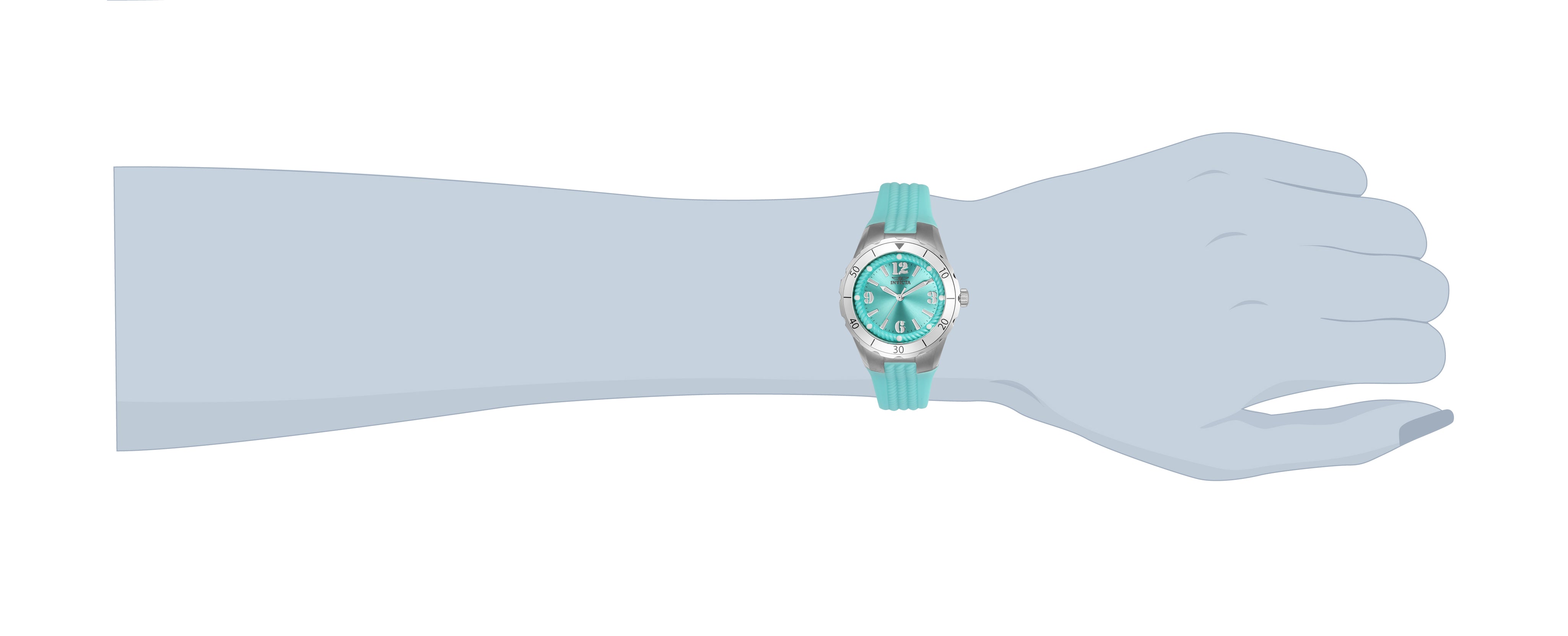 169377_24124-wrist.jpg
