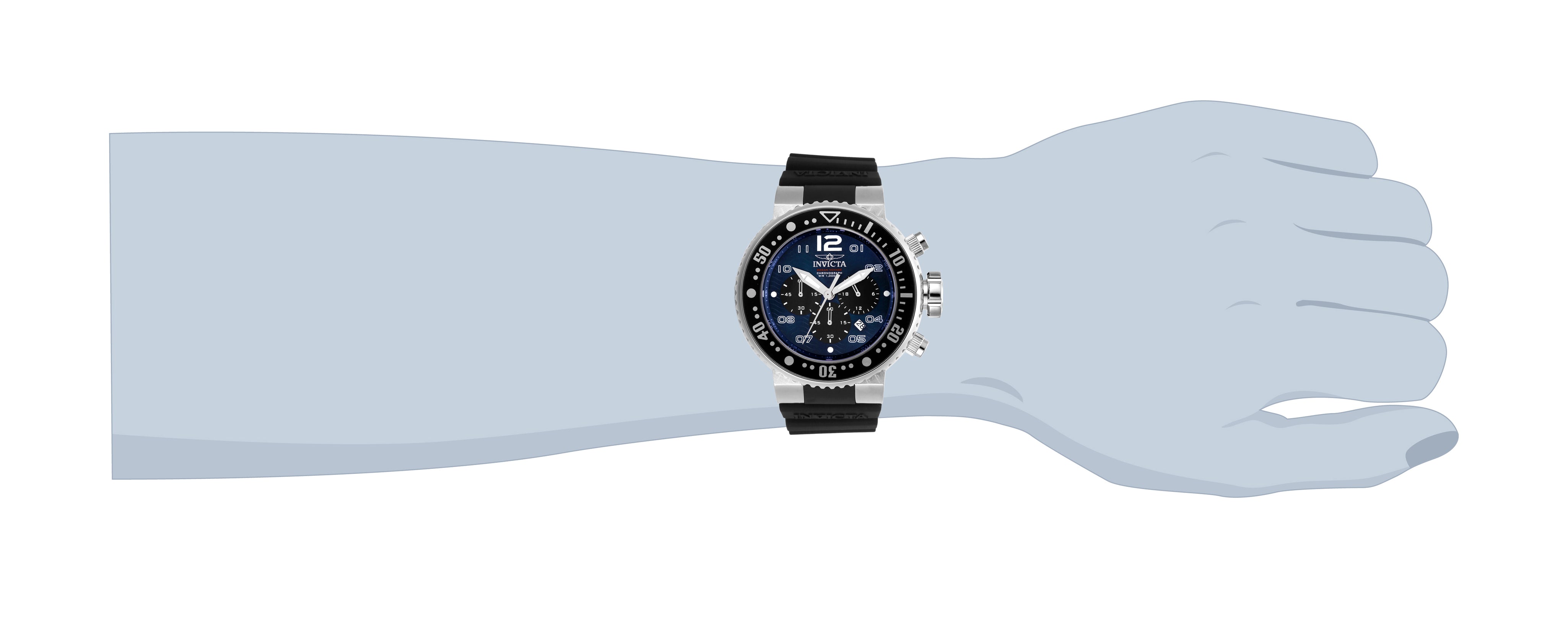 226605_26731-wrist.jpg